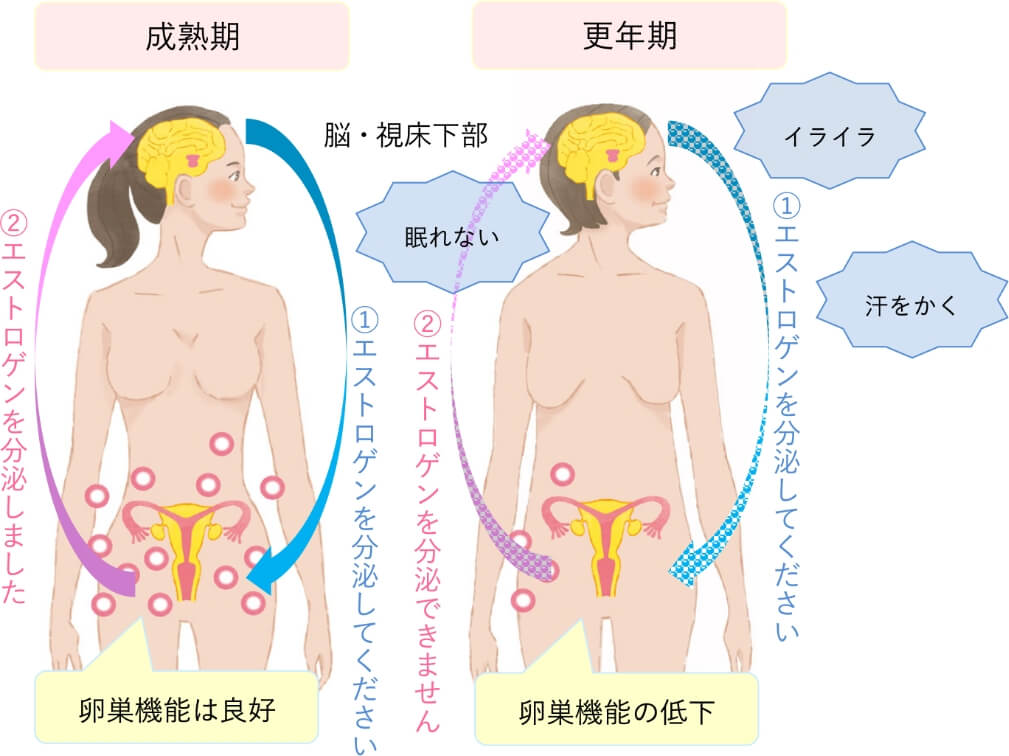 図解3