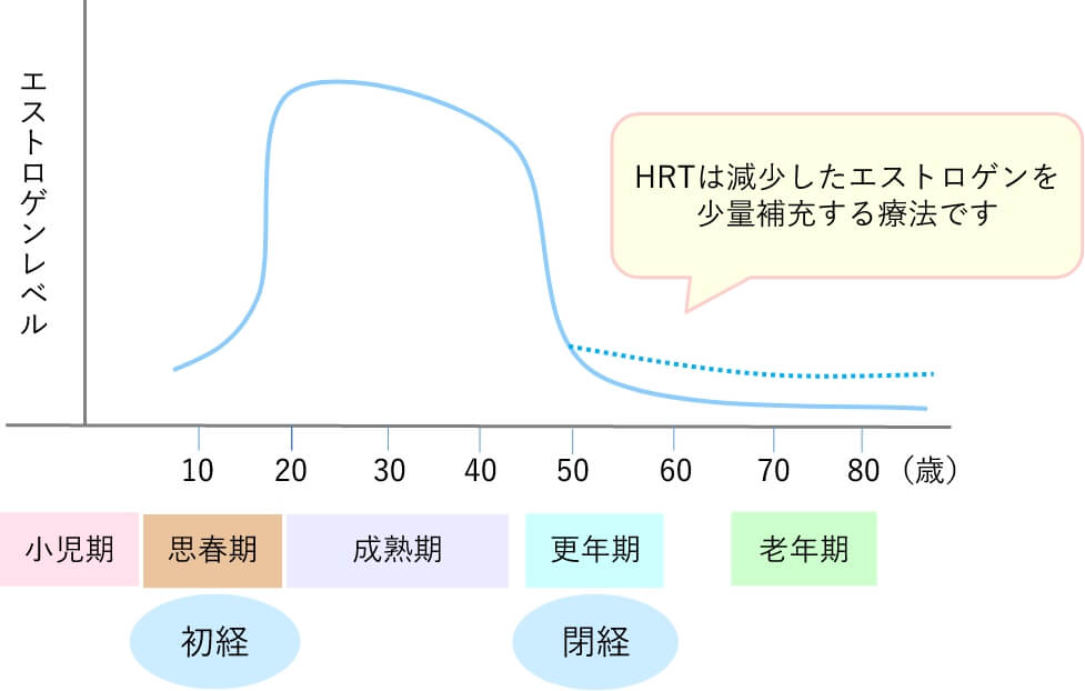 図解